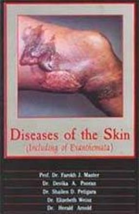Diseases of the Skin (Including of Exanthemata)