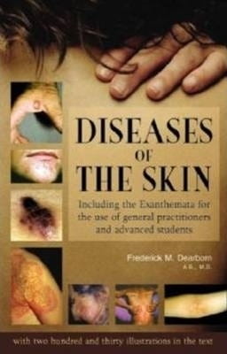 Diseases of the Skin: Including the Exanthemata