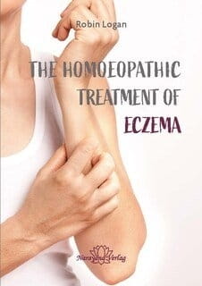 The Homeopathic Treatment of Eczema